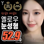 옐로우 토탈 눈성형 자연유착 매몰쌍꺼풀 눈매교정 절개 트임