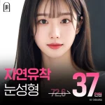 자연유착 눈성형