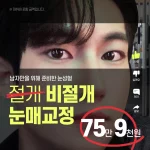 잘생긴 남자눈성형