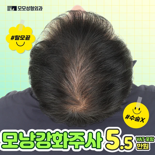 탈모치료 광고 이미지로 모낭강화주사 가격이 표시됨