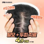 볼륨빵빵 모모 탈모치료